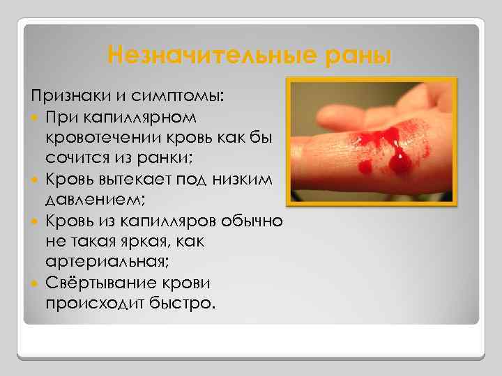 Незначительные раны Признаки и симптомы: При капиллярном кровотечении кровь как бы сочится из ранки;