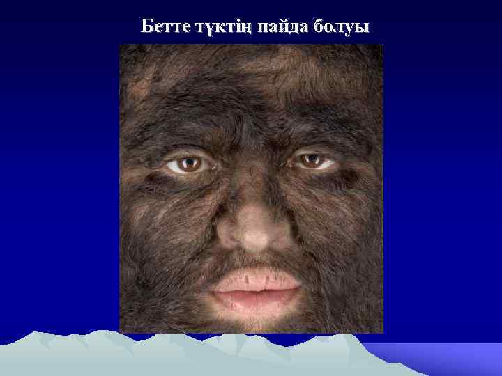 Бетте түктің пайда болуы 