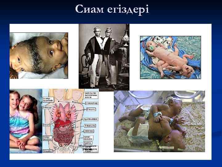 Сиам егіздері 