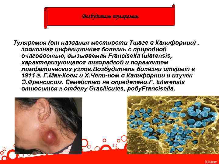 Возбудитель туляремии Туляремия (от названия местности Тшаге в Калифорнии). зоонозная инфекционная болезнь с природной