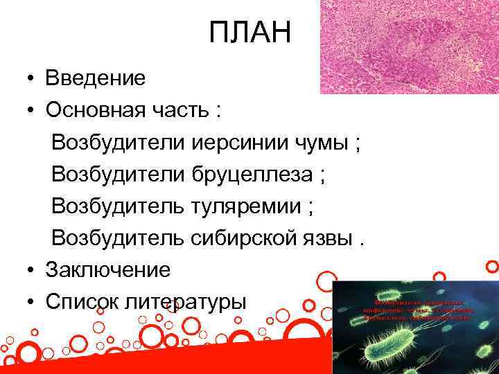 ПЛАН • Введение • Основная часть : Возбудители иерсинии чумы ; Возбудители бруцеллеза ;