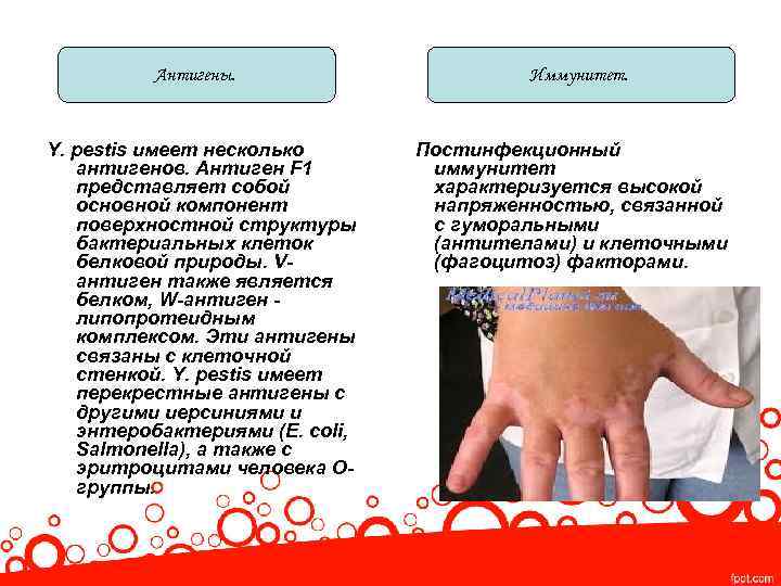 Антигены. Y. pestis имеет несколько антигенов. Антиген F 1 представляет собой основной компонент поверхностной