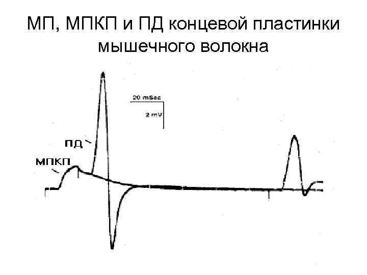 МП, МПКП и ПД концевой пластинки мышечного волокна 