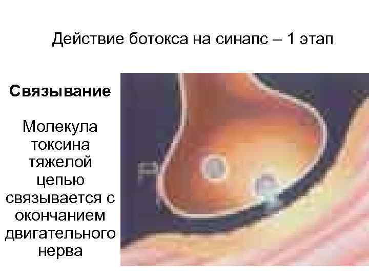 Действие ботокса на синапс – 1 этап Связывание Молекула токсина тяжелой цепью связывается с