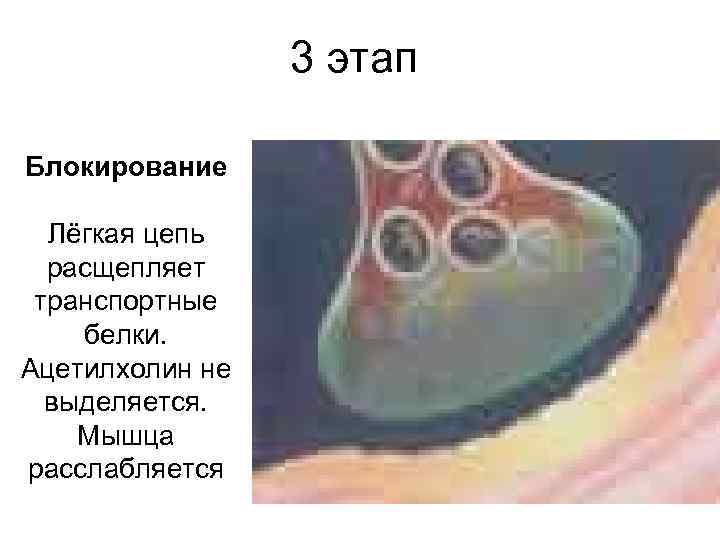 3 этап Блокирование Лёгкая цепь расщепляет транспортные белки. Ацетилхолин не выделяется. Мышца расслабляется 