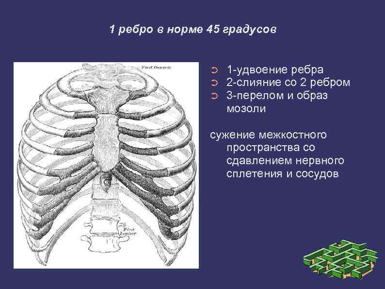 Два ребра выходящие. 1 И 2 ребро. Строение 2 ребра. Первое ребро.