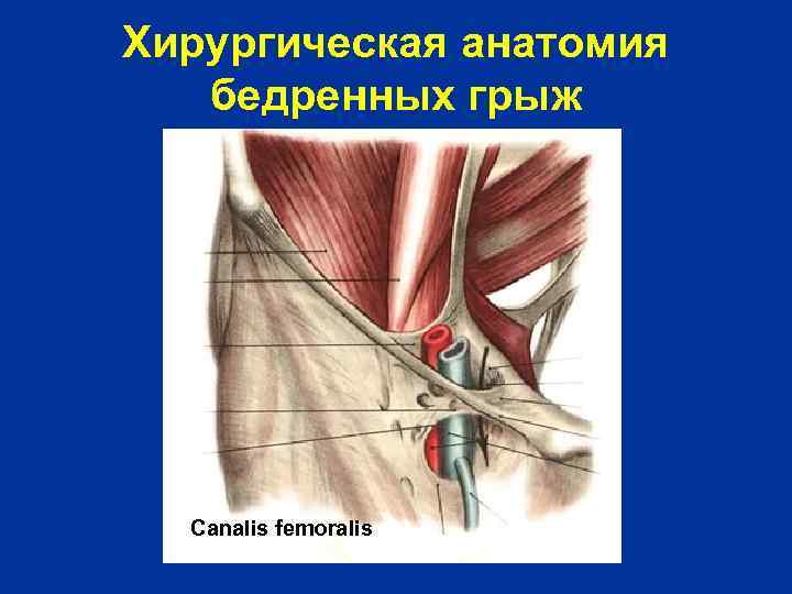 Хирургическая анатомия бедренных грыж Canalis femoralis 