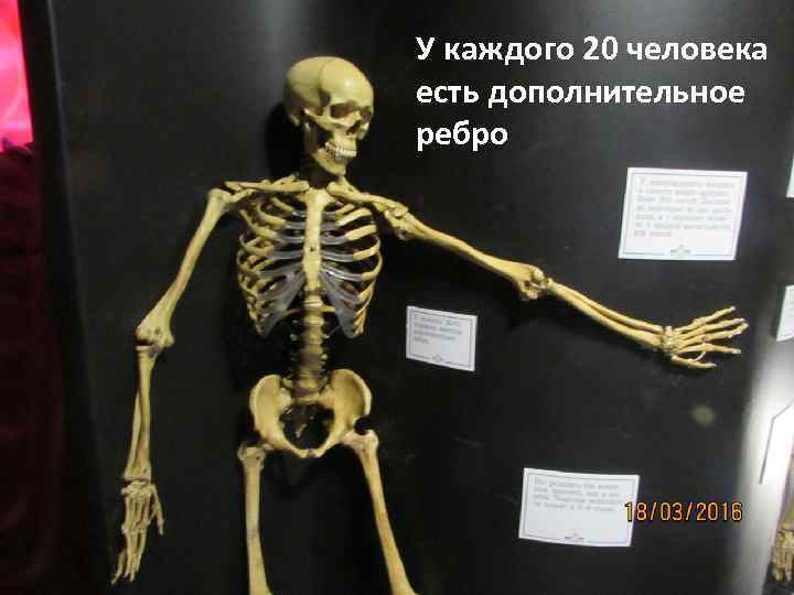 У каждого 20 человека есть дополнительное ребро 