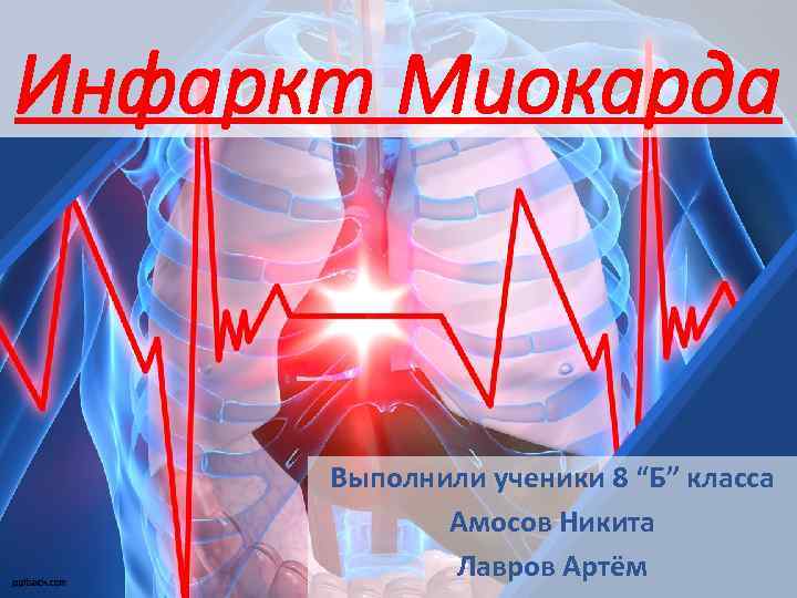 Инфаркт Миокарда Выполнили ученики 8 “Б” класса Амосов Никита Лавров Артём 