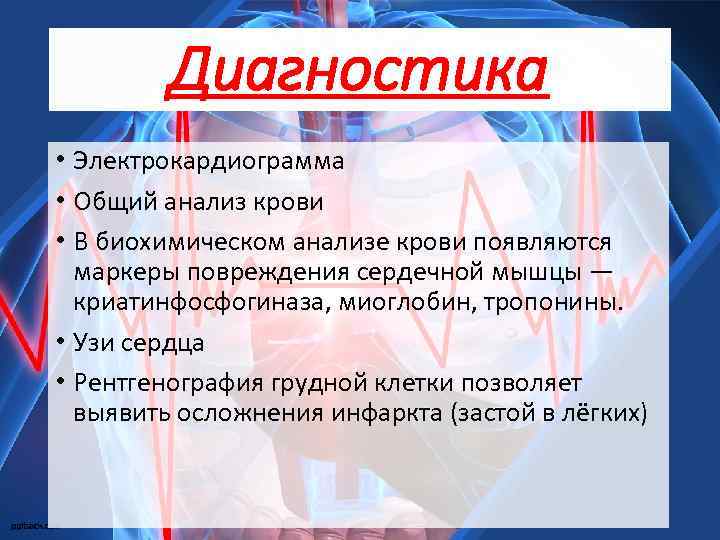 Диагностика • Электрокардиограмма • Общий анализ крови • В биохимическом анализе крови появляются маркеры