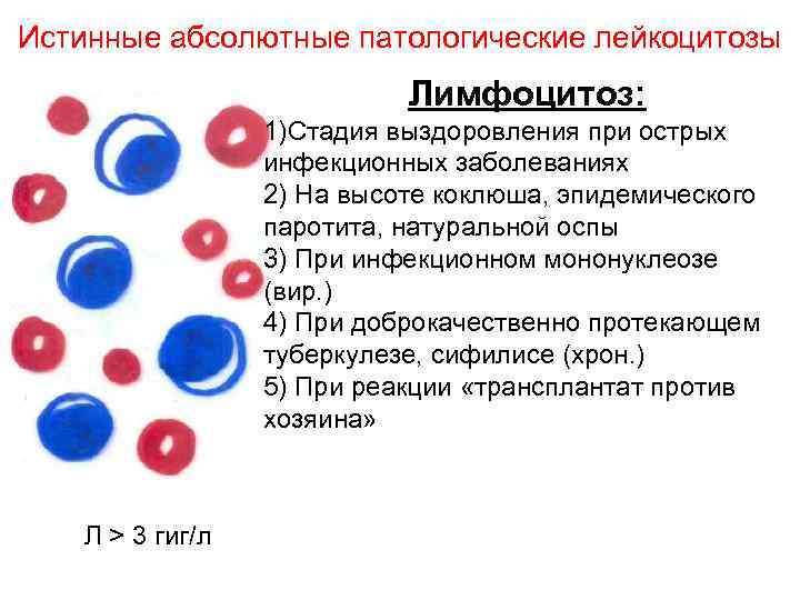 Истинные абсолютные патологические лейкоцитозы Лимфоцитоз: 1)Стадия выздоровления при острых инфекционных заболеваниях 2) На высоте