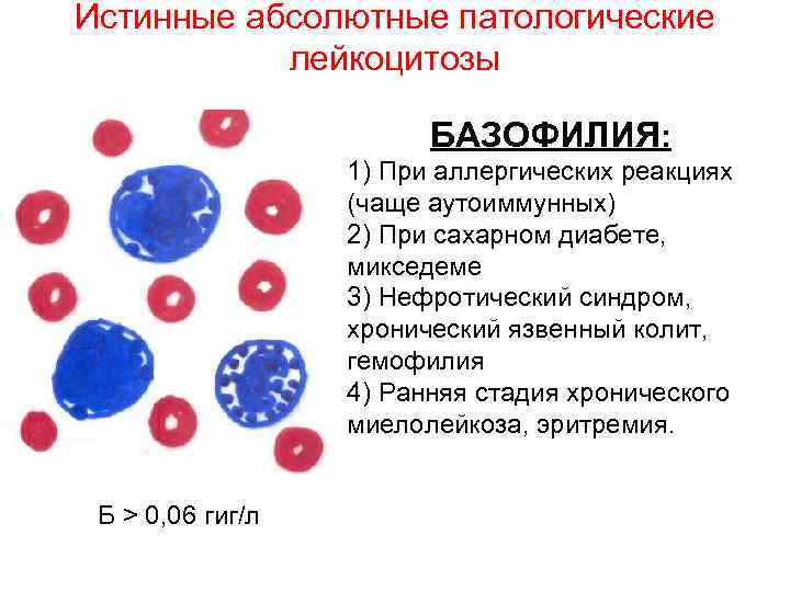 Истинные абсолютные патологические лейкоцитозы БАЗОФИЛИЯ: 1) При аллергических реакциях (чаще аутоиммунных) 2) При сахарном