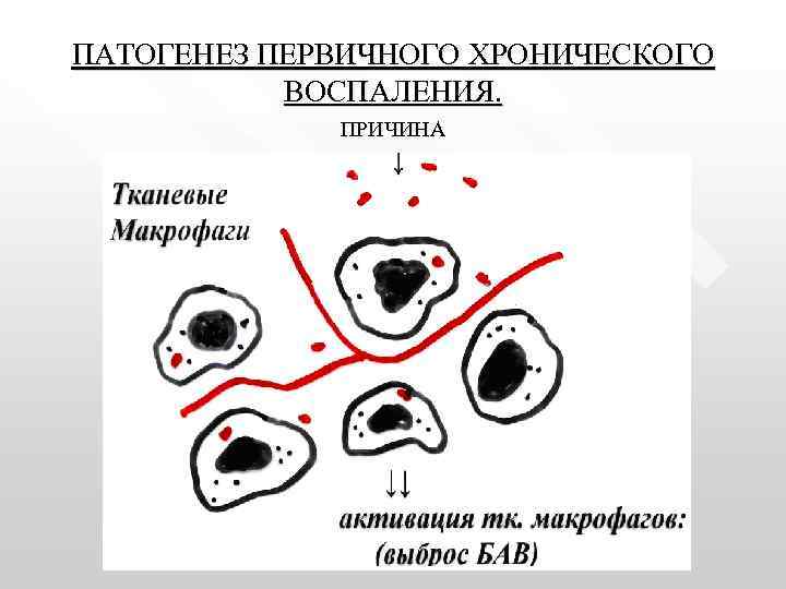ПАТОГЕНЕЗ ПЕРВИЧНОГО ХРОНИЧЕСКОГО ВОСПАЛЕНИЯ. ПРИЧИНА 