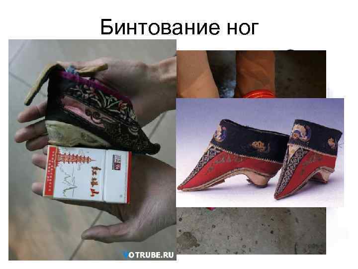 Бинтование ног 