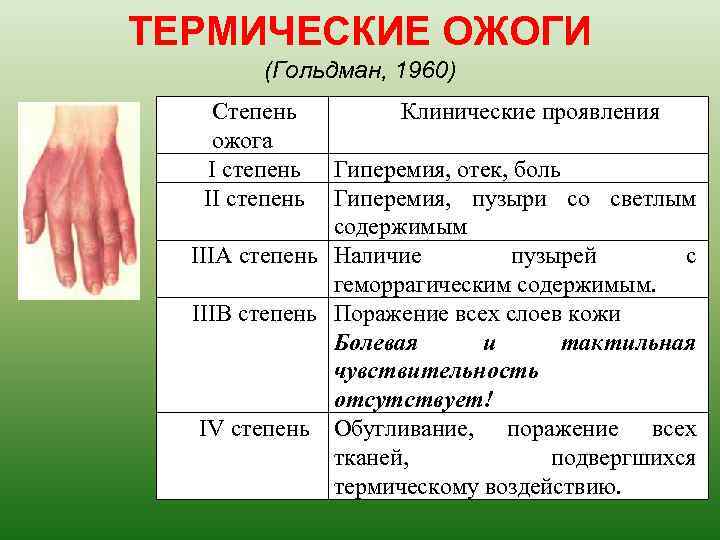 ТЕРМИЧЕСКИЕ ОЖОГИ (Гольдман, 1960) Степень ожога I степень II степень Клинические проявления Гиперемия, отек,