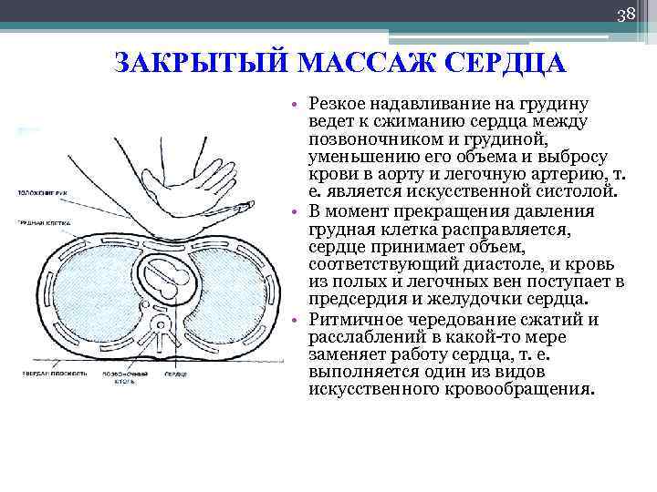 38 ЗАКРЫТЫЙ МАССАЖ СЕРДЦА • Резкое надавливание на грудину ведет к сжиманию сердца между