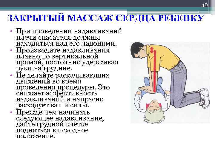 Закрытый массаж сердца