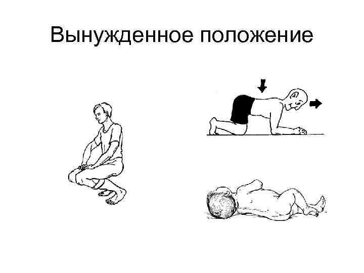 Вынужденное положение 