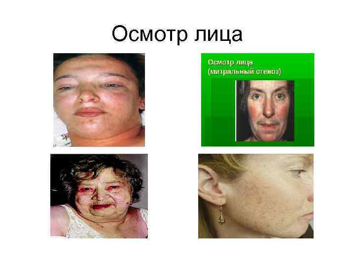 Осмотр лица 