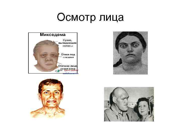 Осмотр лица 