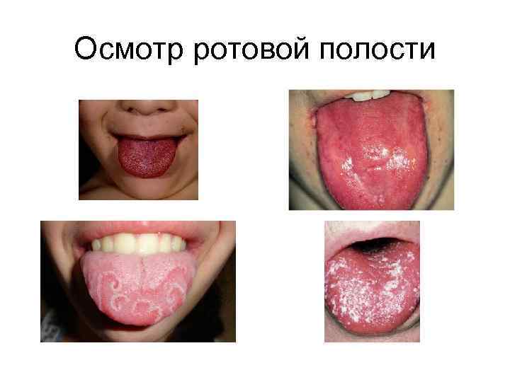 Осмотр ротовой полости 