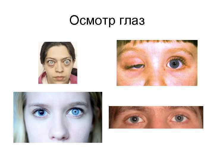 Осмотр глаз 