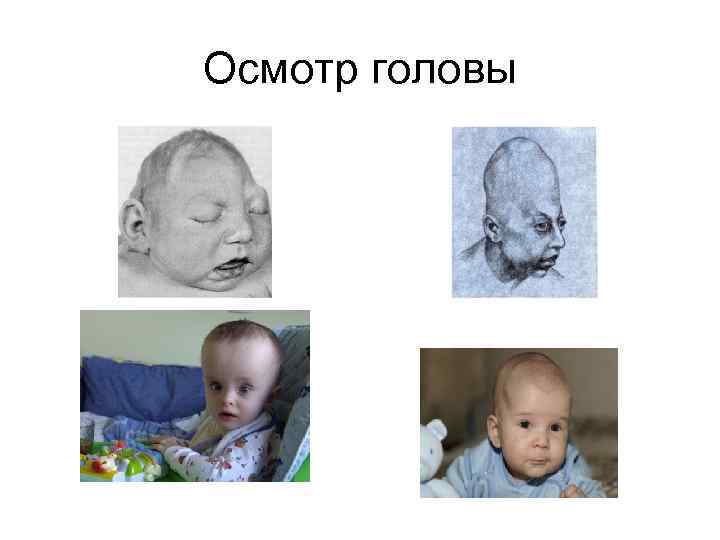 Осмотр головы 