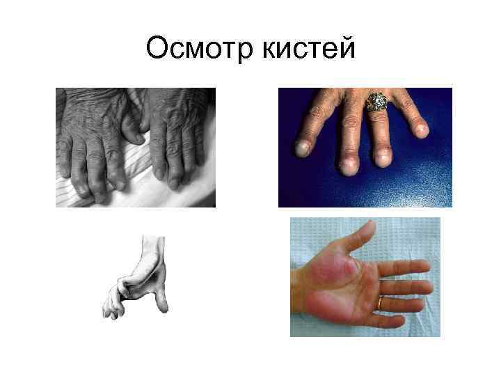 Осмотр кистей 