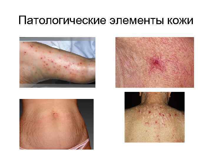 Патологические элементы кожи 