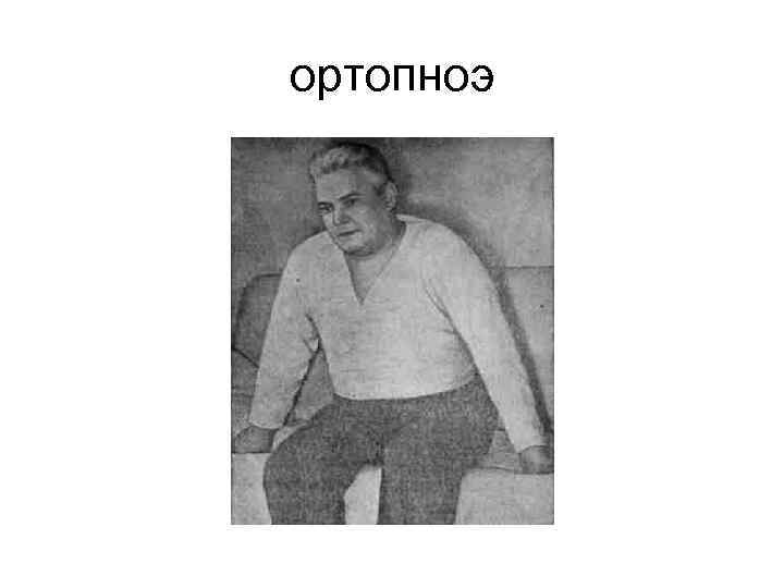 ортопноэ 