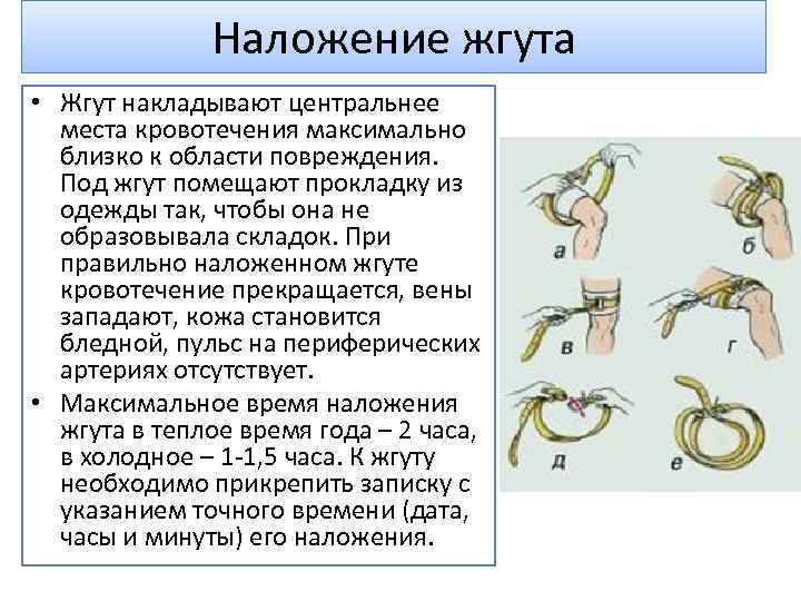 Наложение жгута • Жгут накладывают центральнее места кровотечения максимально близко к области повреждения. Под