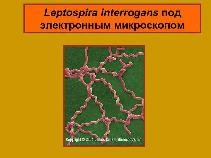 Leptospira interrogans под электронным микроскопом 