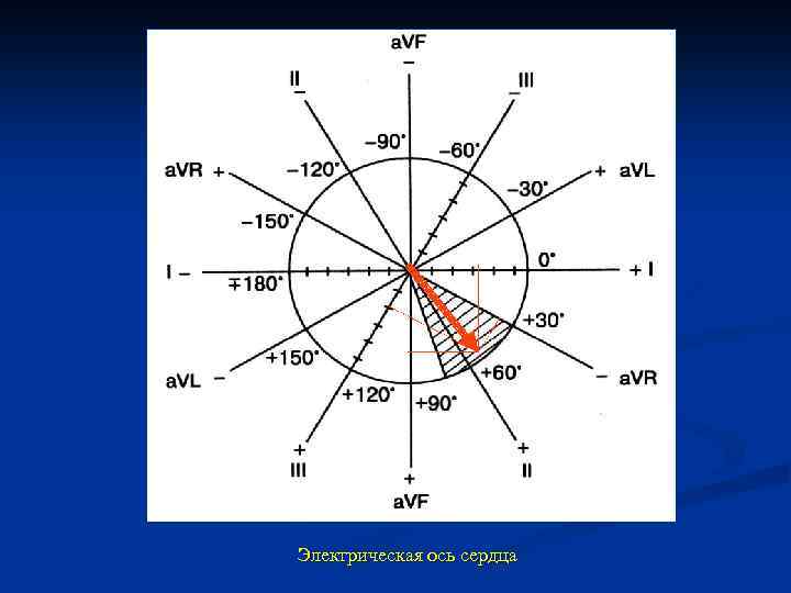 Электрическая ось сердца 