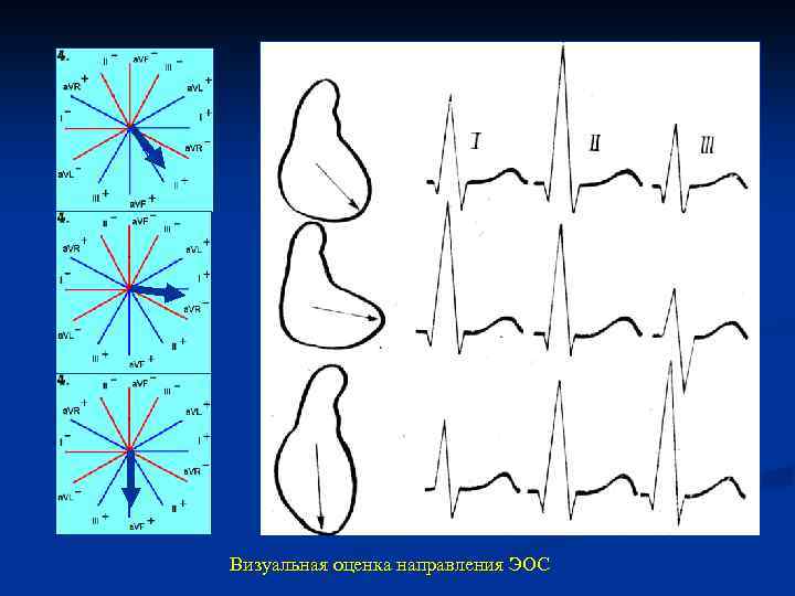 Визуальная оценка направления ЭОС 