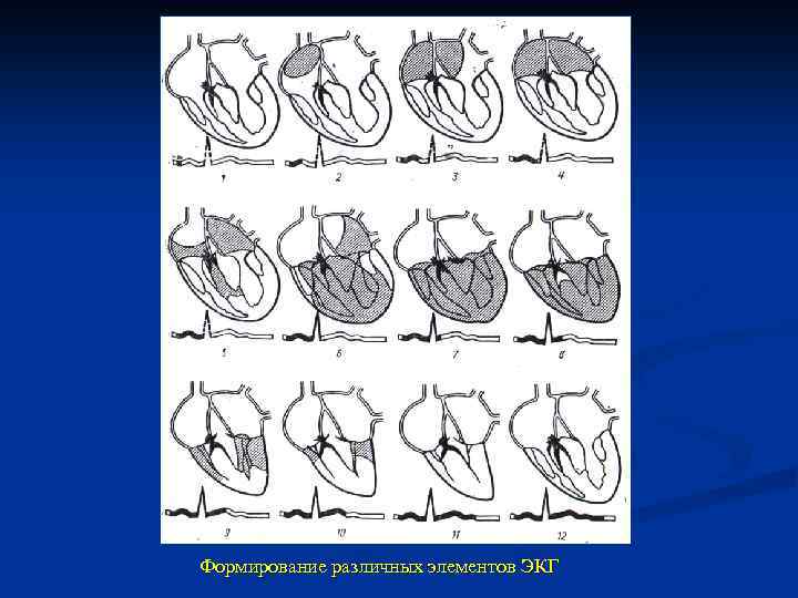 Формирование различных элементов ЭКГ 