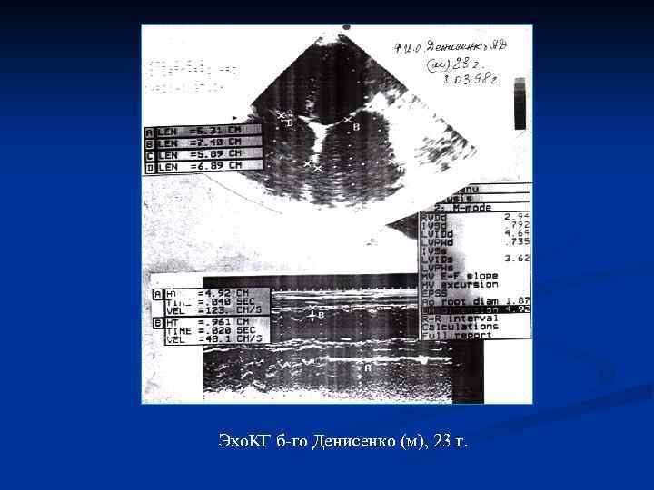 Эхо. КГ б-го Денисенко (м), 23 г. 