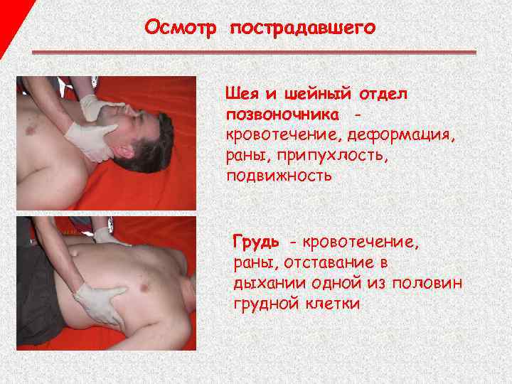 Осмотр пострадавшего Шея и шейный отдел позвоночника кровотечение, деформация, раны, припухлость, подвижность Грудь -