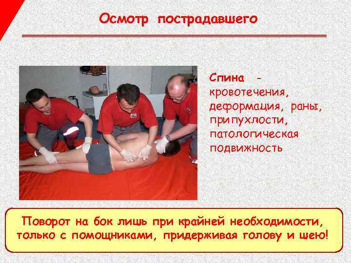 Осмотр пострадавшего Спина кровотечения, деформация, раны, припухлости, патологическая подвижность Поворот на бок лишь при