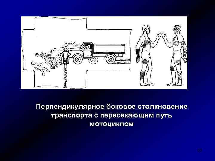 Перпендикулярное боковое столкновение транспорта с пересекающим путь мотоциклом 62 