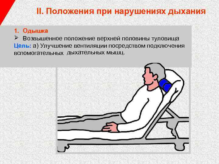 II. Положения при нарушениях дыхания 1. Одышка Ø Возвышенное положение верхней половины туловища Цель: