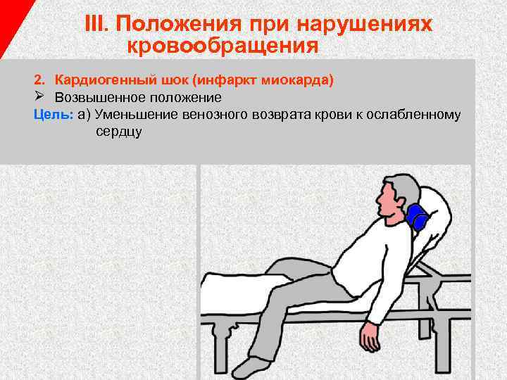 III. Положения при нарушениях кровообращения 2. Кардиогенный шок (инфаркт миокарда) Ø Возвышенное положение Цель: