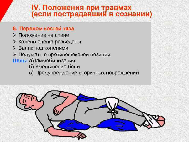 IV. Положения при травмах (если пострадавший в сознании) 6. Перелом костей таза Ø Положение