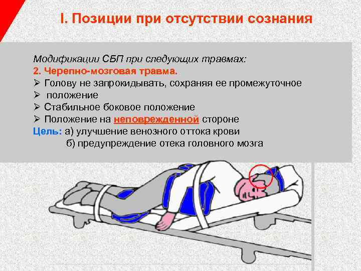 I. Позиции при отсутствии сознания Модификации СБП при следующих травмах: 2. Черепно-мозговая травма. Ø
