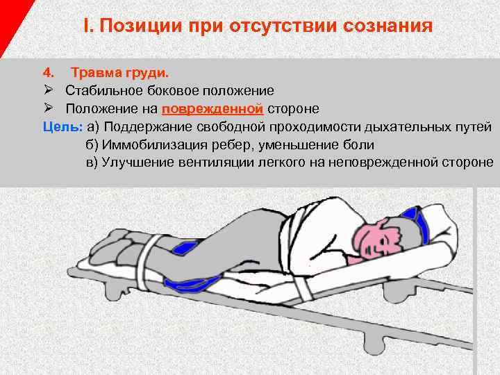 I. Позиции при отсутствии сознания 4. Травма груди. Ø Стабильное боковое положение Ø Положение