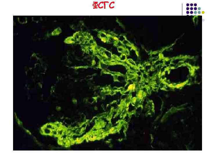 ФСГС 
