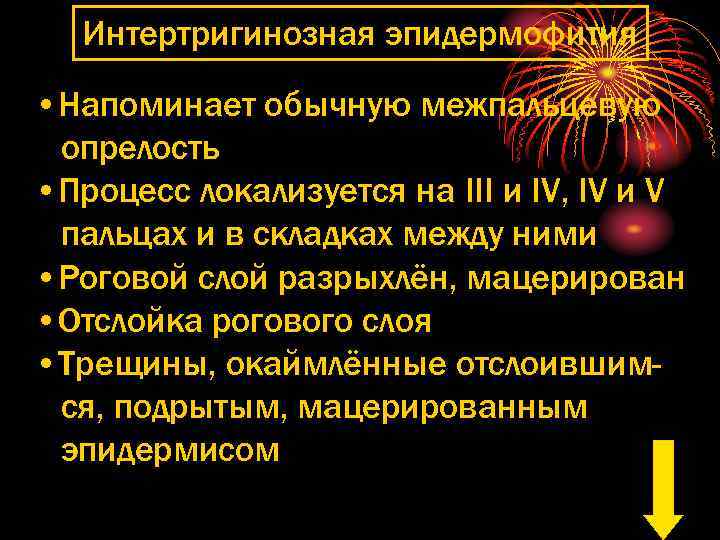 Интертригинозная эпидермофития • Напоминает обычную межпальцевую опрелость • Процесс локализуется на III и IV,