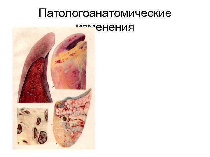 Патологоанатомические изменения 