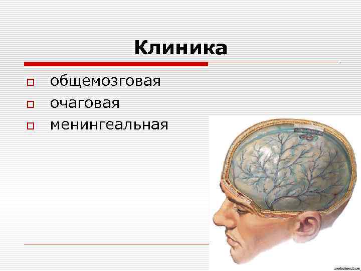 Клиника o o o общемозговая очаговая менингеальная 