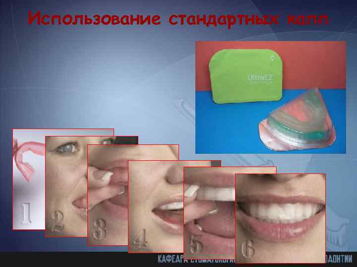 Использование стандартных капп 