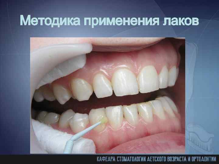 Методика применения лаков 